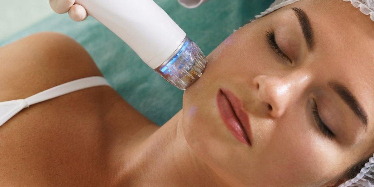 RF Microneedling