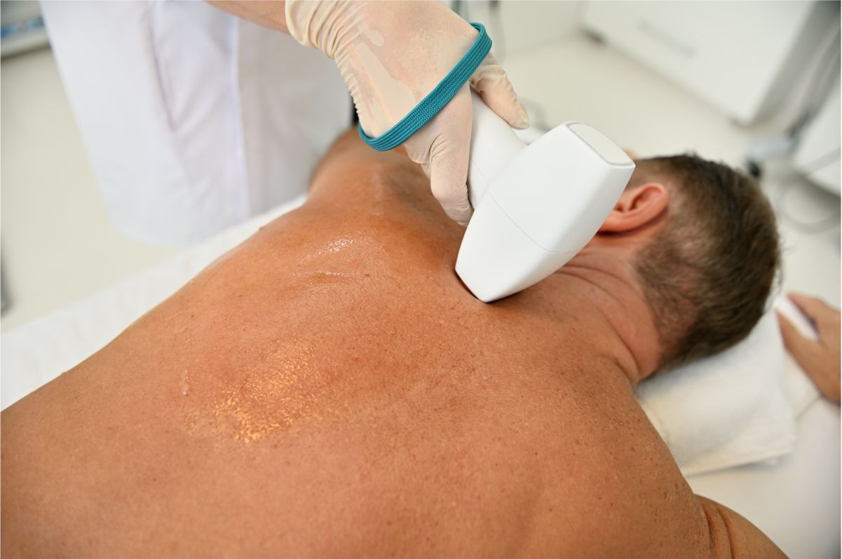 Diode Laser Hair Removal-Lower Or Upper Back