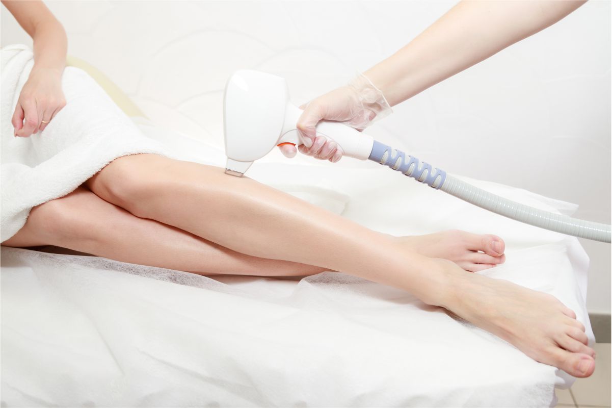 Diode Laser Hair Removal-Upper Half Leg(Excluding Knees)