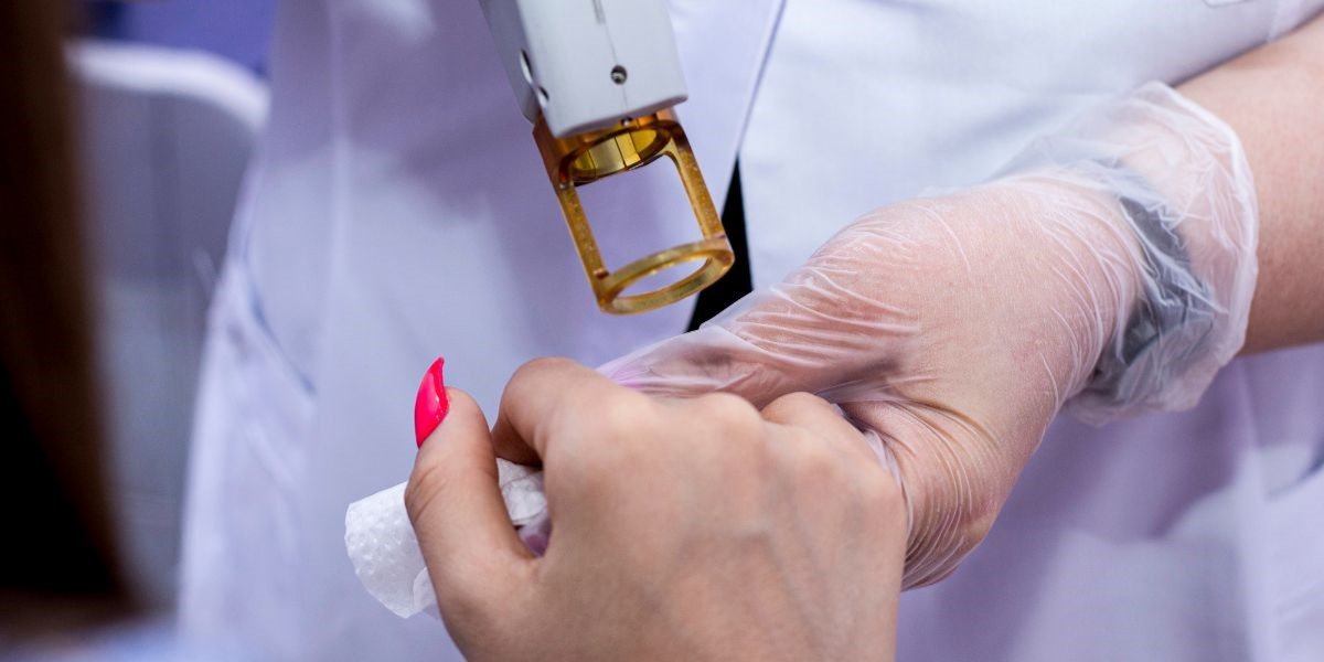 Co2 Laser Resurfacing For Hands