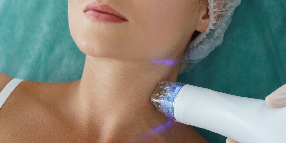 Rf Radio-Frequency Microneedling-Neck