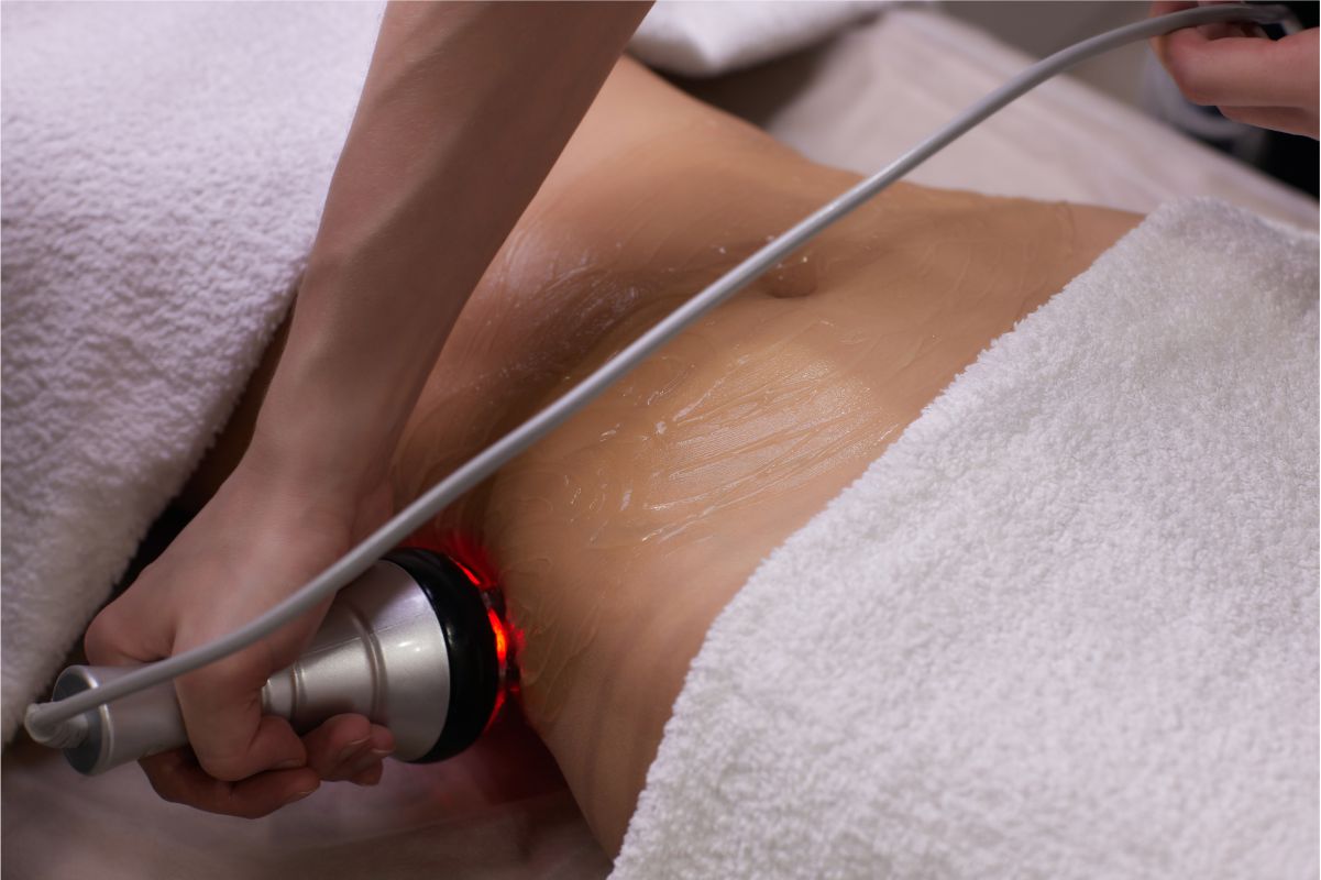 Ultrasound Cavitation-Love Handles