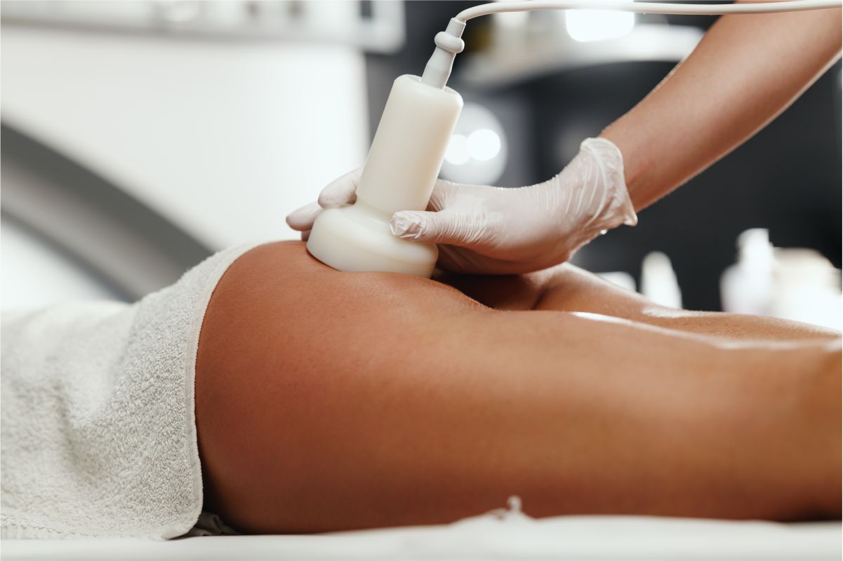 Ultrasound Cavitation-Buttocks, Saddle Backs & Back Thighs