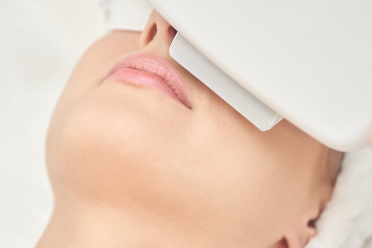 co2 laser treatment