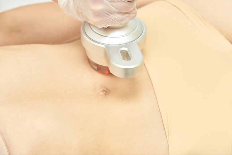 Non surgical fat reduction