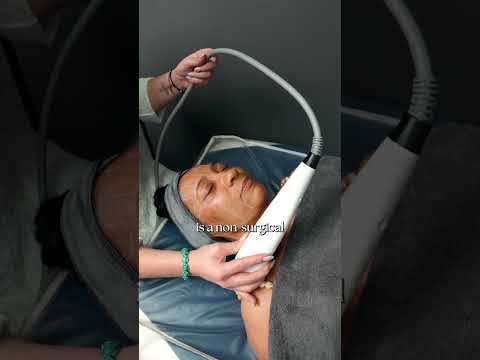 HIFU non invasive face lift